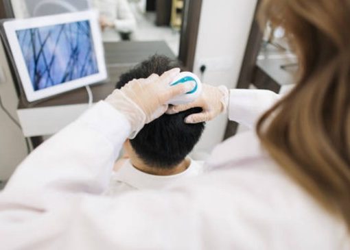 頭皮檢測