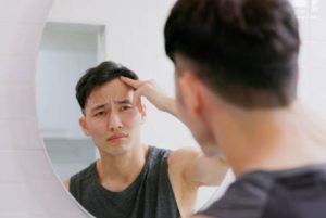 男士脫髮